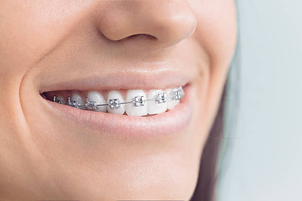 Trusted Northgate, OH Dental Services Experts
